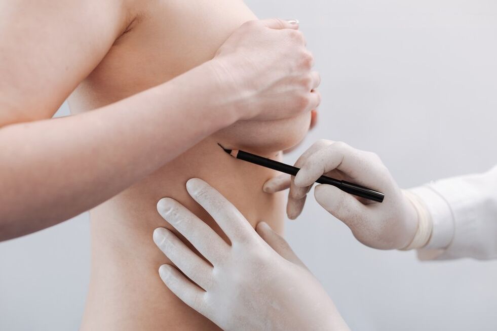příprava na chirurgickou augmentaci prsou