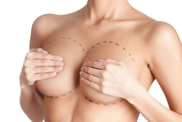 označení pro operaci zvětšení prsou