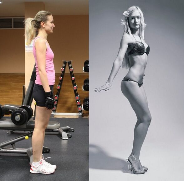 před a po zvětšení prsou úpravou držení těla